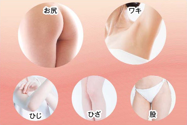 黒ずみバイバイ お尻 ワキ ヒジ ヒザ 股の黒ずみを解消する専用スキンケア Campfire キャンプファイヤー 黒ずみバイバイ お尻 ワキ ヒジ ヒザ 股の黒ずみを解消する専用スキンケア Campfire キャンプファイヤー