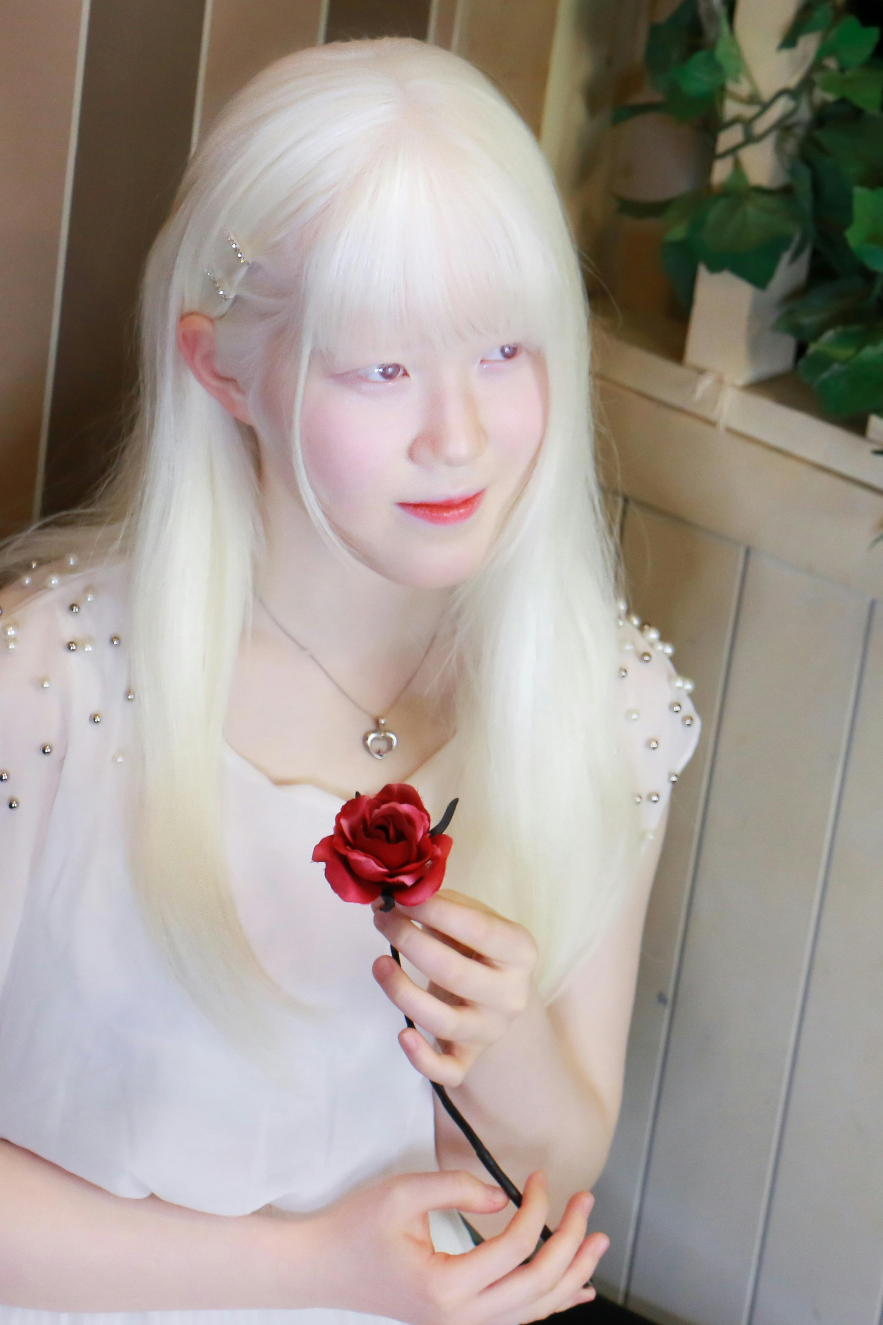 アルビノ モデル写真集制作プロジェクト Campfire キャンプファイヤー アルビノ モデル写真集制作プロジェクト Campfire キャンプファイヤー