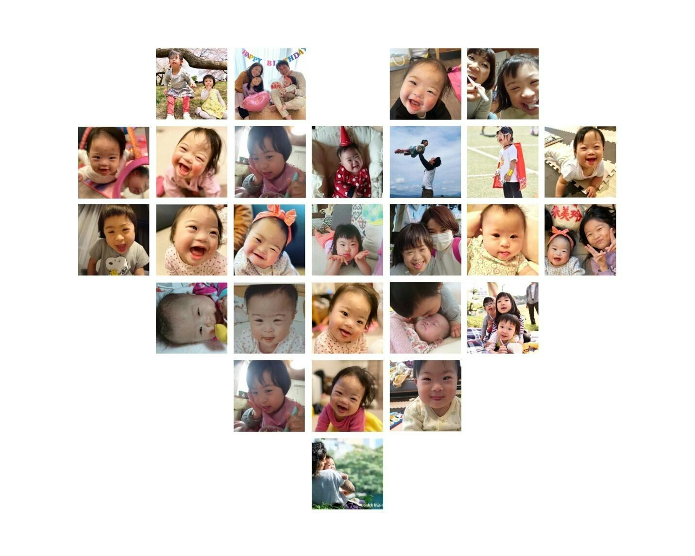 同じ 顔 ダウン症 同じ 顔 ダウン症