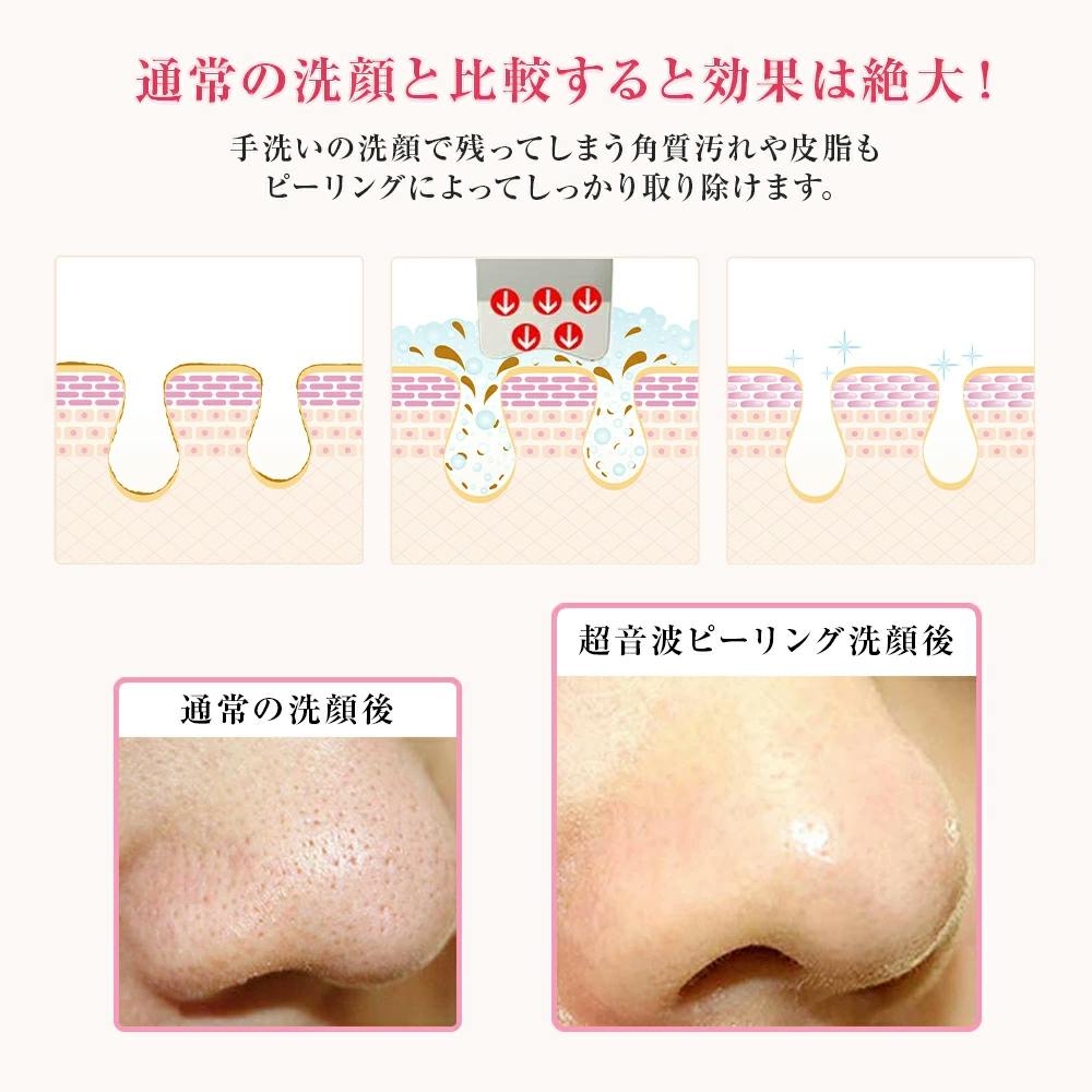 お肌は口ほどのものを言う 女性も男性もお肌のケアを Skin Pro 誕生 Campfire キャンプファイヤー お肌は口ほどのものを言う 女性も男性もお肌のケアを Skin Pro 誕生 Campfire キャンプファイヤー