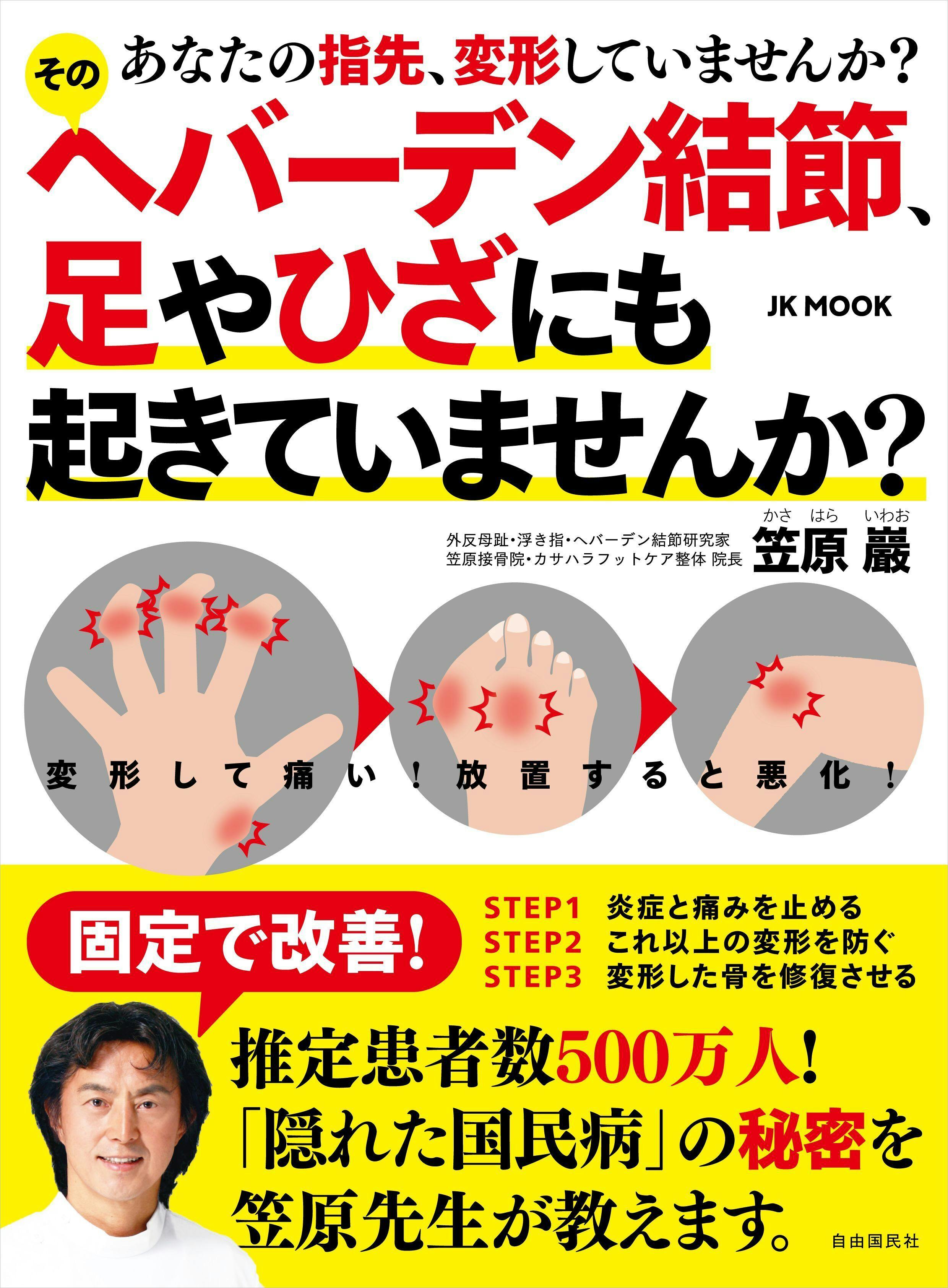 国民病 へバーデン結節 で進む足 手指の関節の変形が止まる 指先テーピング Campfire キャンプファイヤー 国民病 へバーデン結節 で進む足 手指の関節の変形が止まる 指先テーピング Campfire キャンプファイヤー