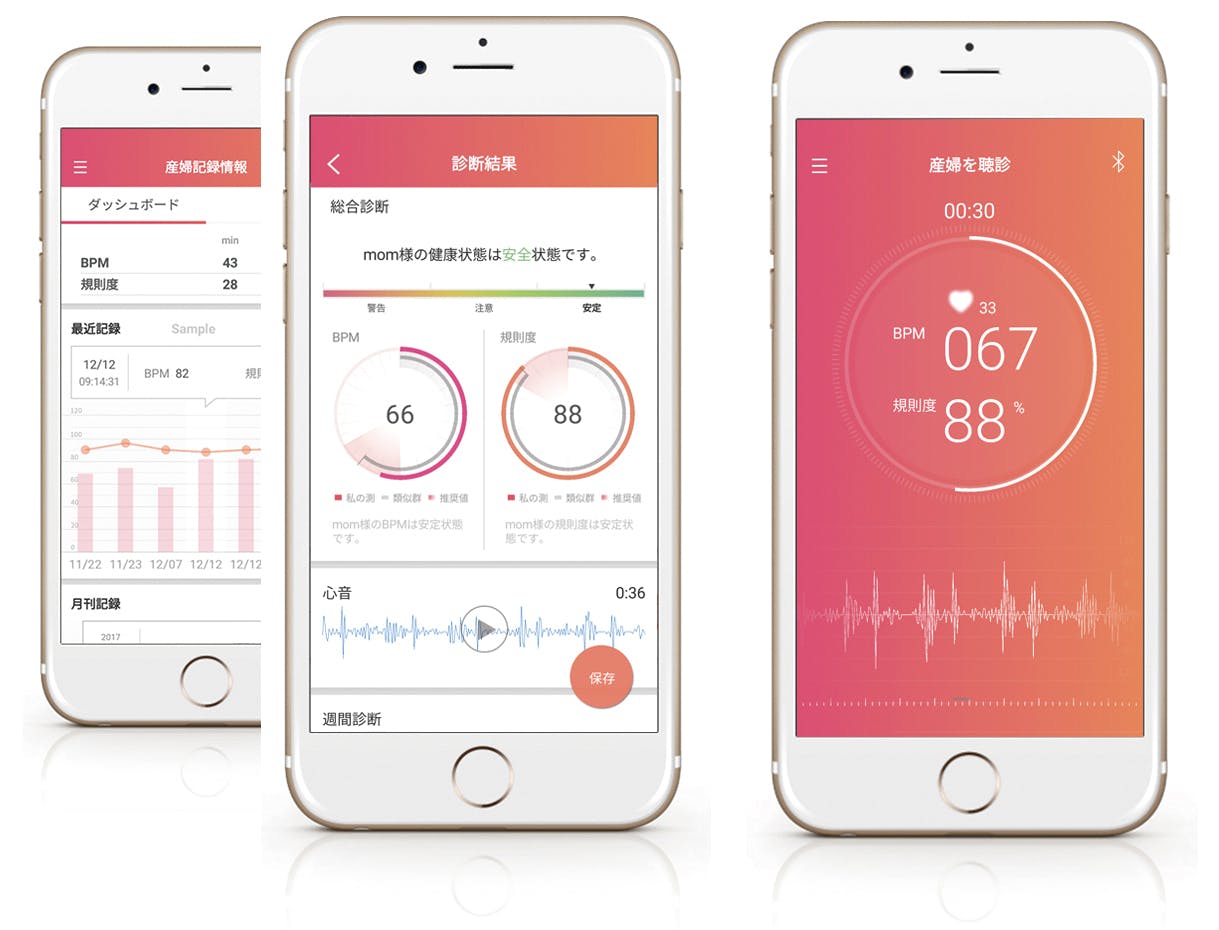 胎児も大人も健康管理 胎児の心音確認も お母さんの心音を子守唄にもskeeper Campfire キャンプファイヤー 胎児も大人も健康管理 胎児の心音確認も お母さんの心音を子守唄にもskeeper Campfire キャンプファイヤー