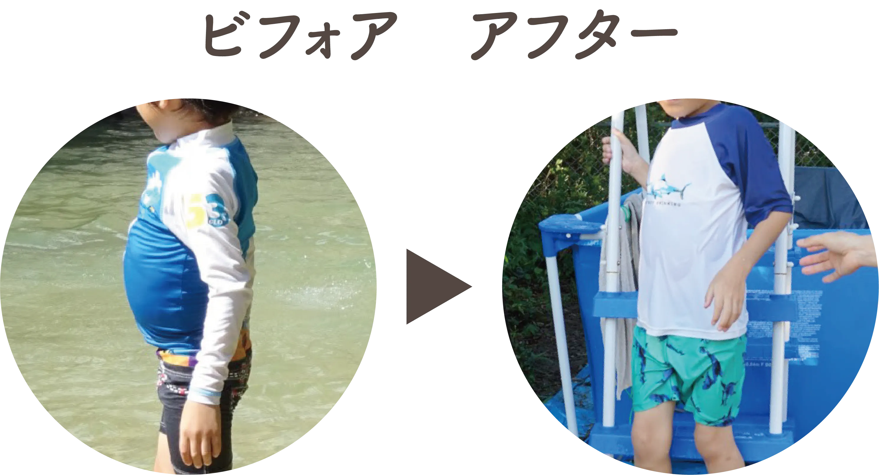 ビフォアアフター