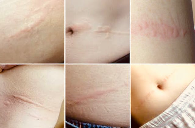 ゴムによる毎日の締め付けストレスから解放されます 無縫製女性用ショーツ Campfire キャンプファイヤー ゴムによる毎日の締め付けストレスから解放されます 無縫製女性用ショーツ Campfire キャンプファイヤー