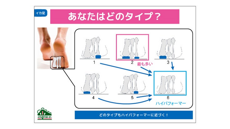 「イカ足」とは？ 2