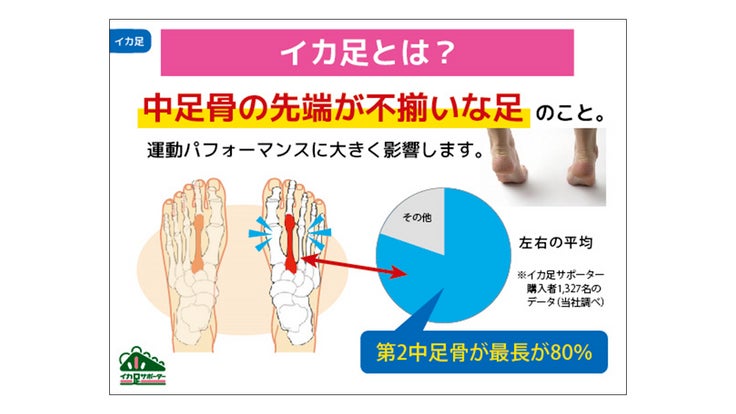 「イカ足」とは？