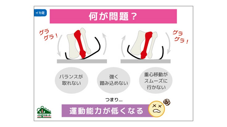 「イカ足」とは？ 4