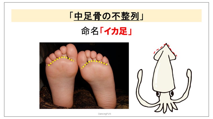 イカ足の名前の由来