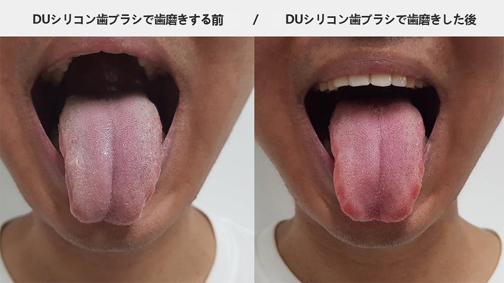 シリコン毛だから歯茎への刺激を最小限に しっかりケアして歯と歯茎健康を保とう Campfire キャンプファイヤー シリコン毛だから歯茎への刺激を最小限に しっかりケアして歯と歯茎健康を保とう Campfire キャンプファイヤー