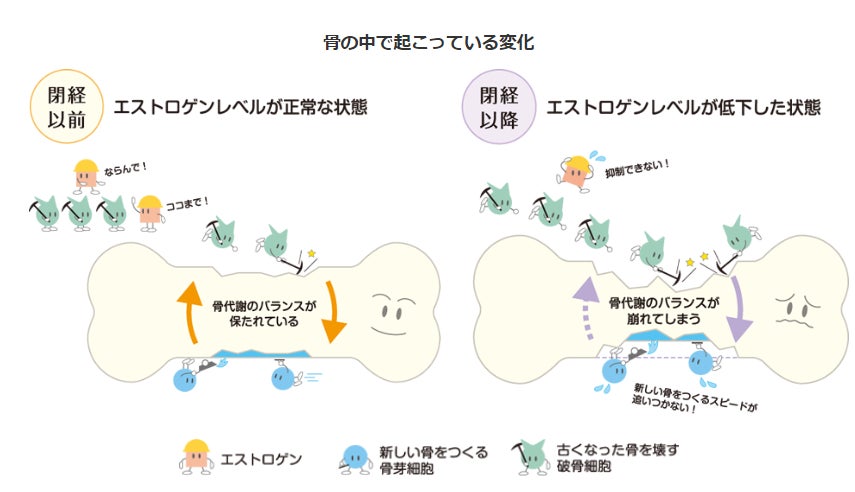 エストロゲンの減少と骨粗鬆症