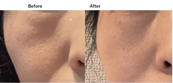 本商品を14週間使用した後