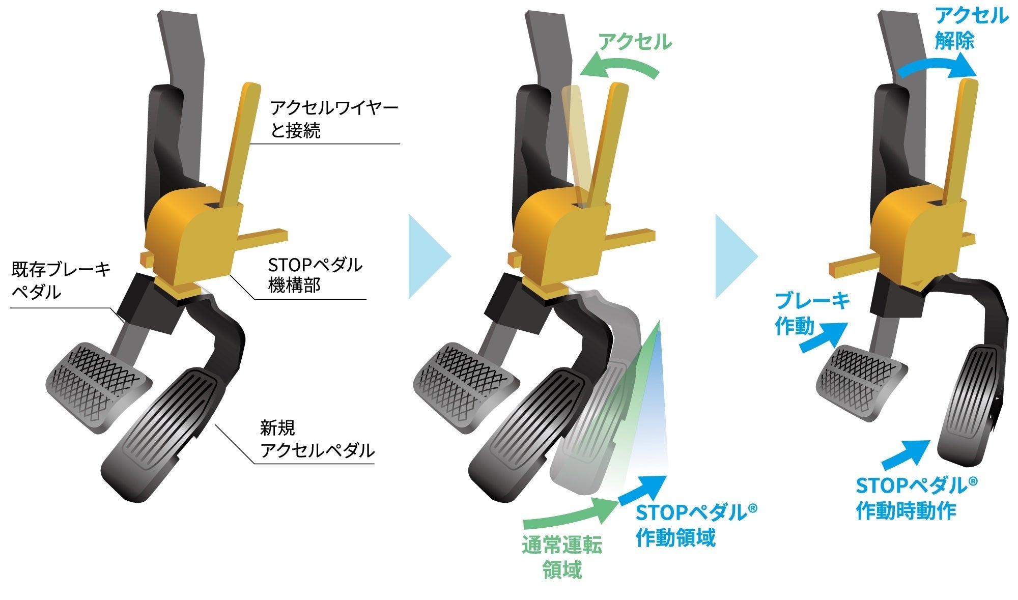 ブレーキ踏み間違えの事故防止に！新開発STOPペダル - CAMPFIRE