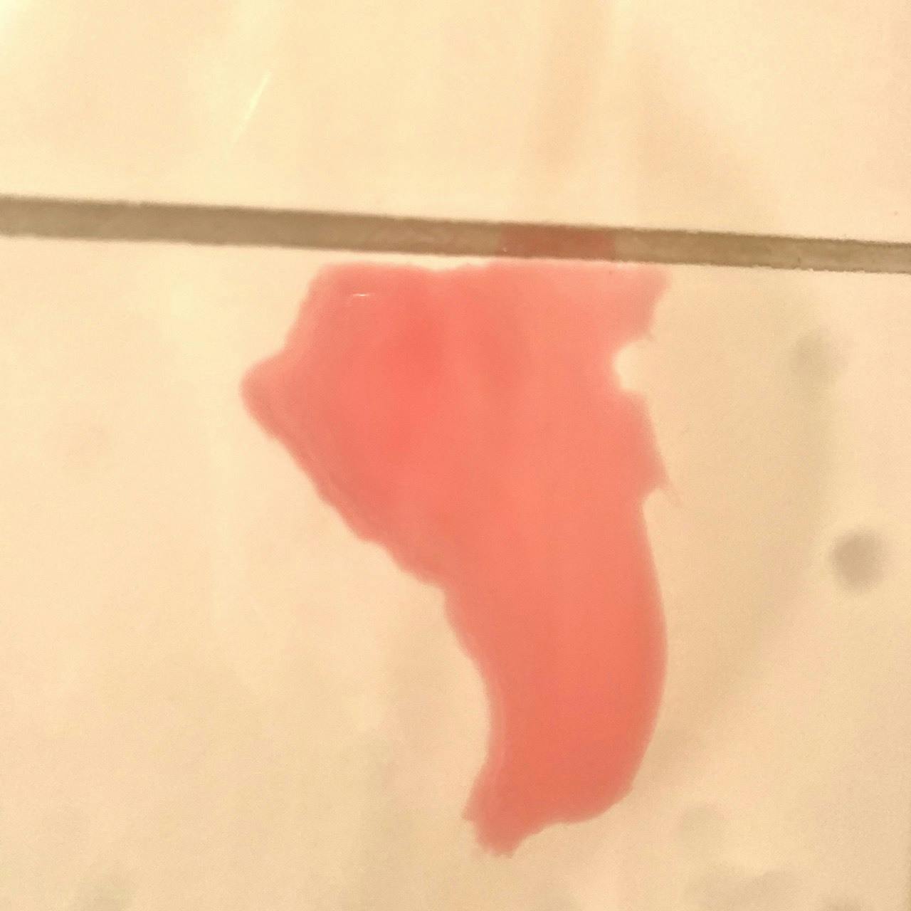 手術 治療費のお願い 長生きできないかも と言われたこの子を救いたい Campfire キャンプファイヤー 手術 治療費のお願い 長生きできないかも と言われたこの子を救いたい Campfire キャンプファイヤー