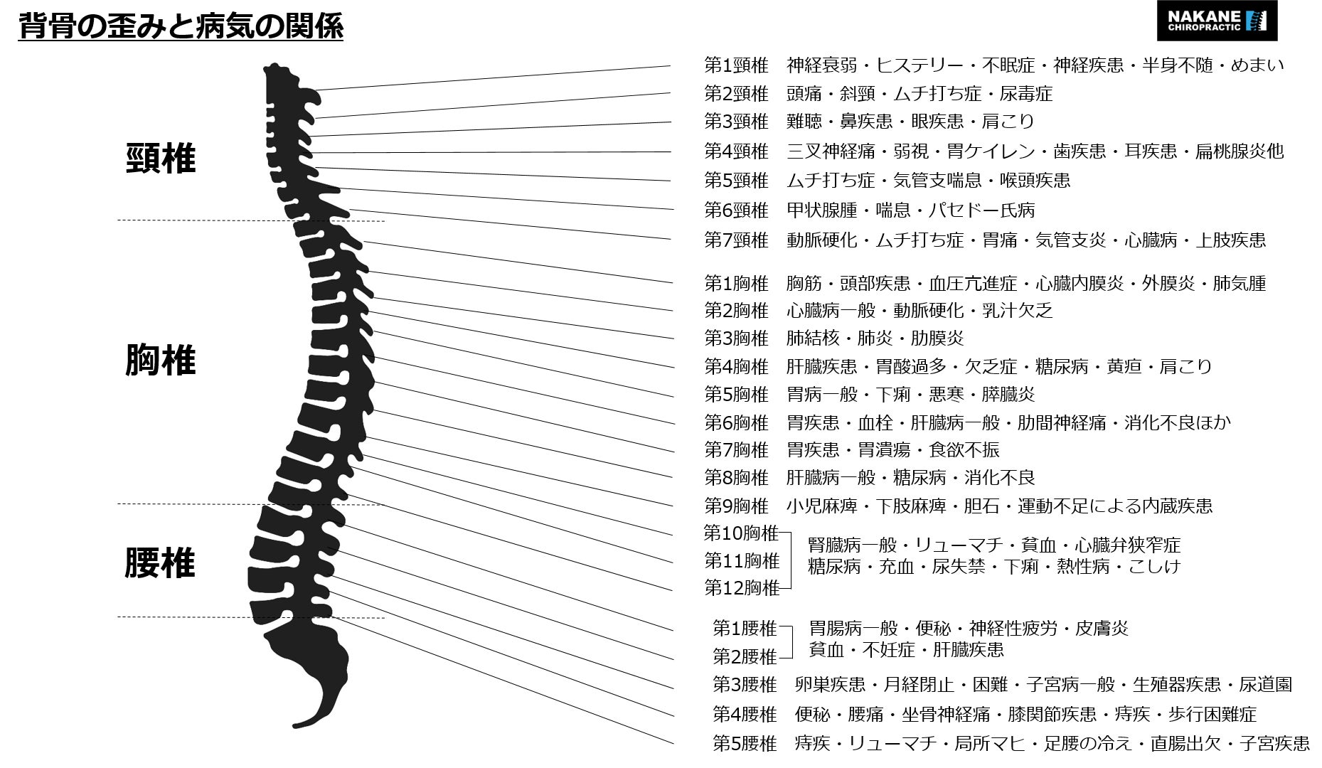 カイロプラクティック　神経説明パネル カイロプラクティックとは。整体の説明。神経圧迫、自然治癒力との関係