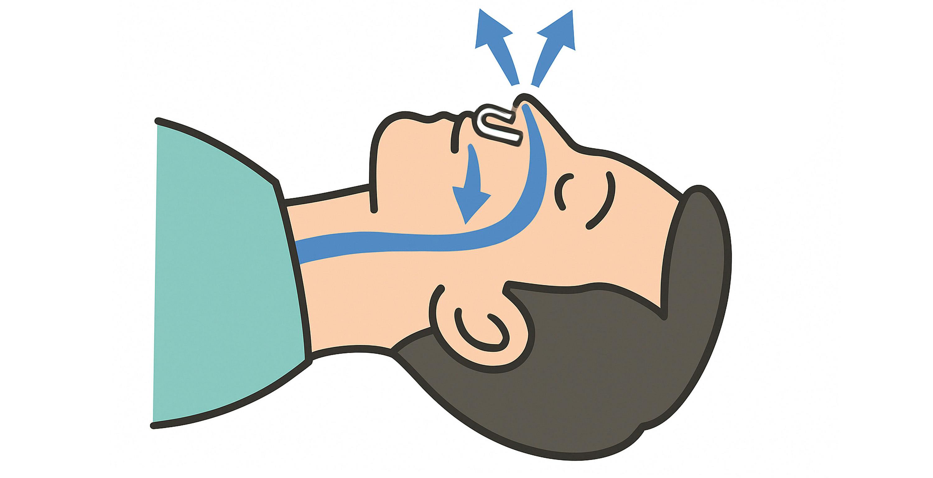 口呼吸から鼻呼吸へ。眠っている間の自然な切り替えをサポート