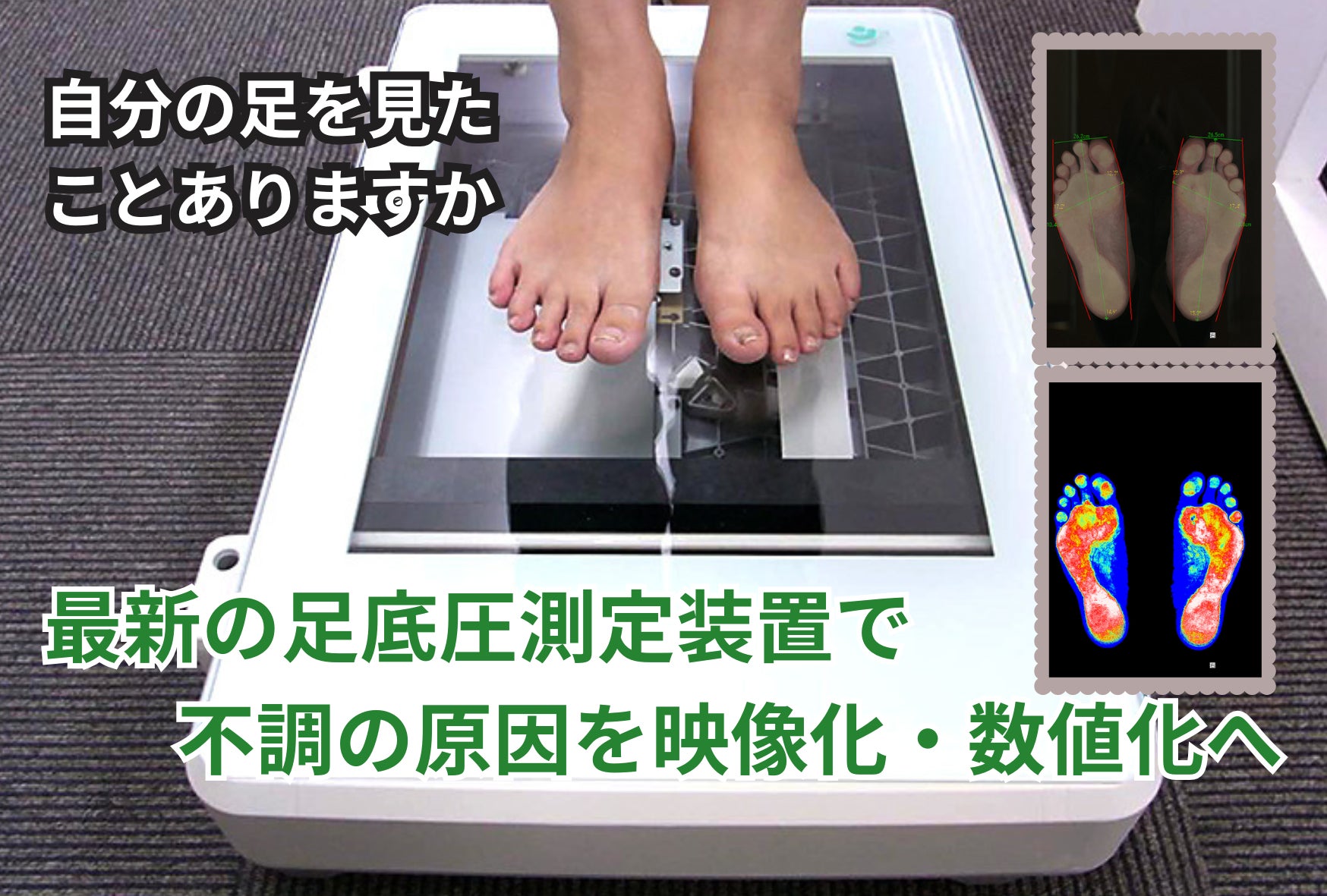 新居浜市】最新の足底圧測定器導入！足の不調を可視化し「一生歩ける体