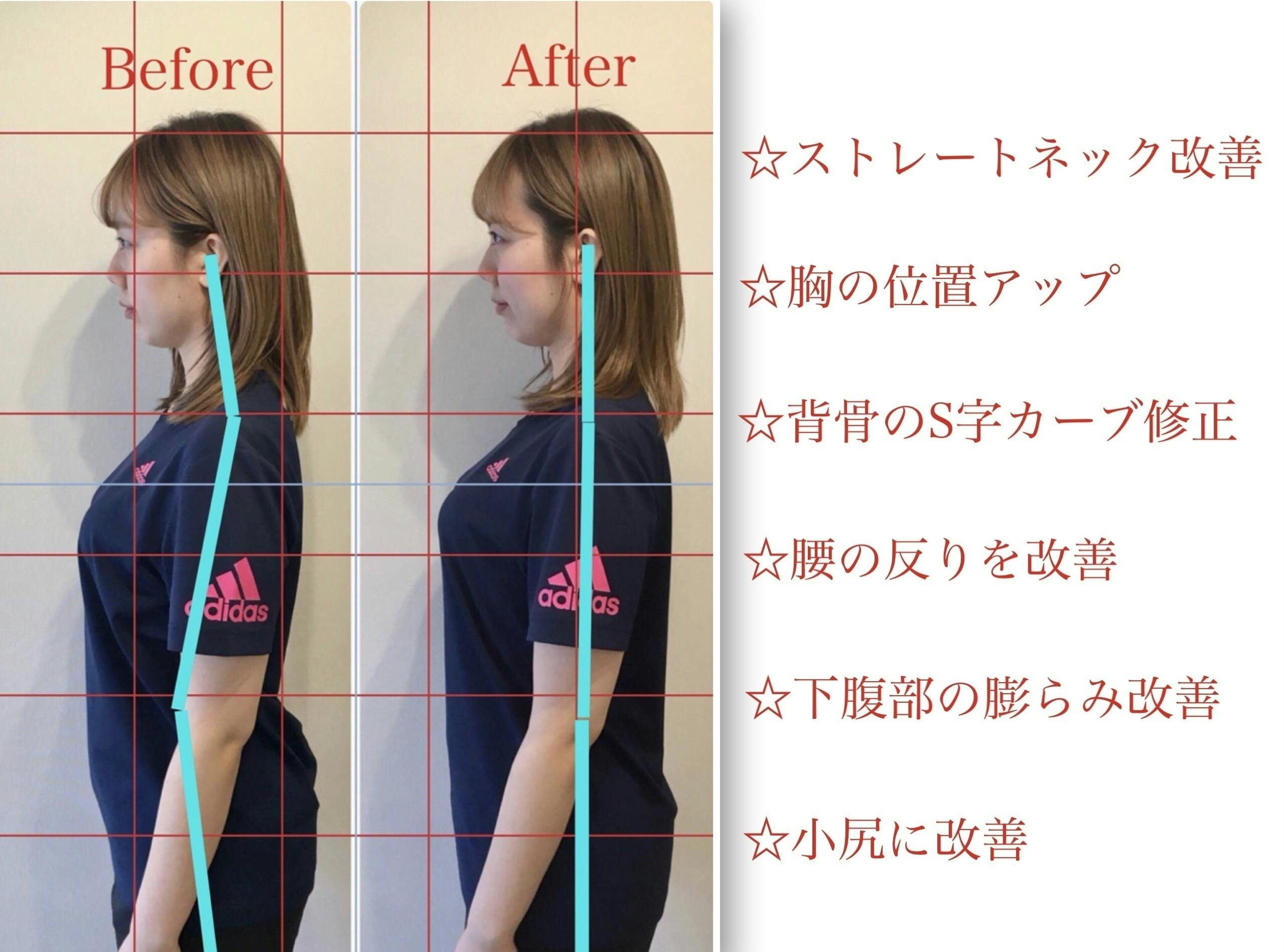 池袋でオープン1周年記念 美容矯正 小顔 O脚 美脚 骨盤背骨 歪み矯正 Campfire キャンプファイヤー 池袋でオープン1周年記念 美容矯正 小顔 O脚 美脚 骨盤背骨 歪み矯正 Campfire キャンプファイヤー