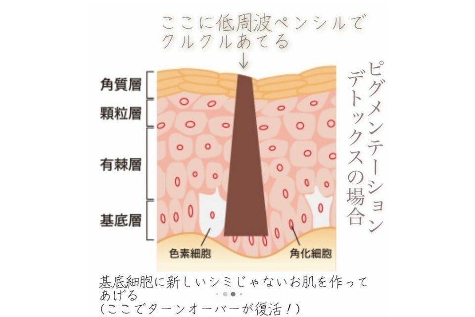 リターン画像