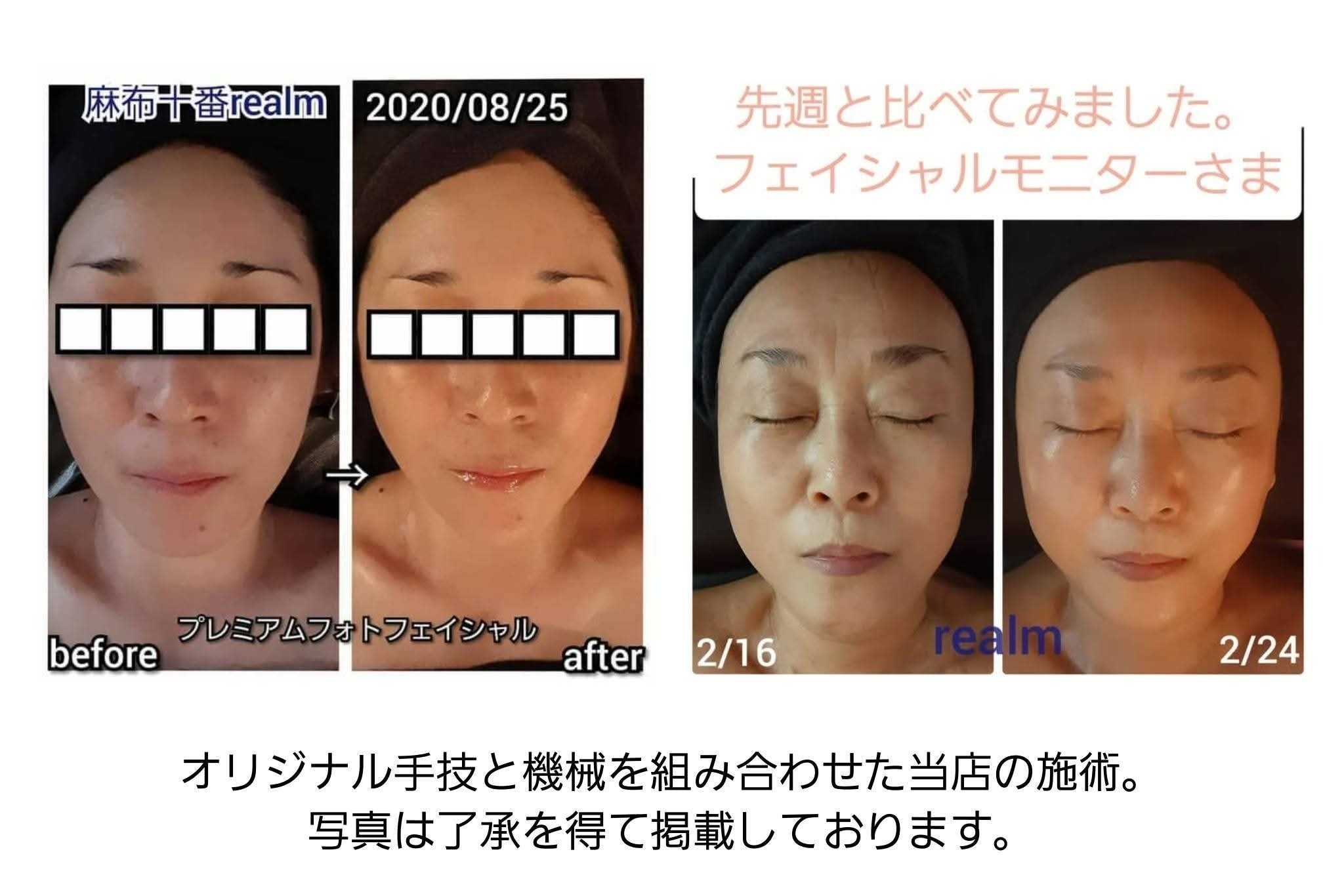 リターン画像