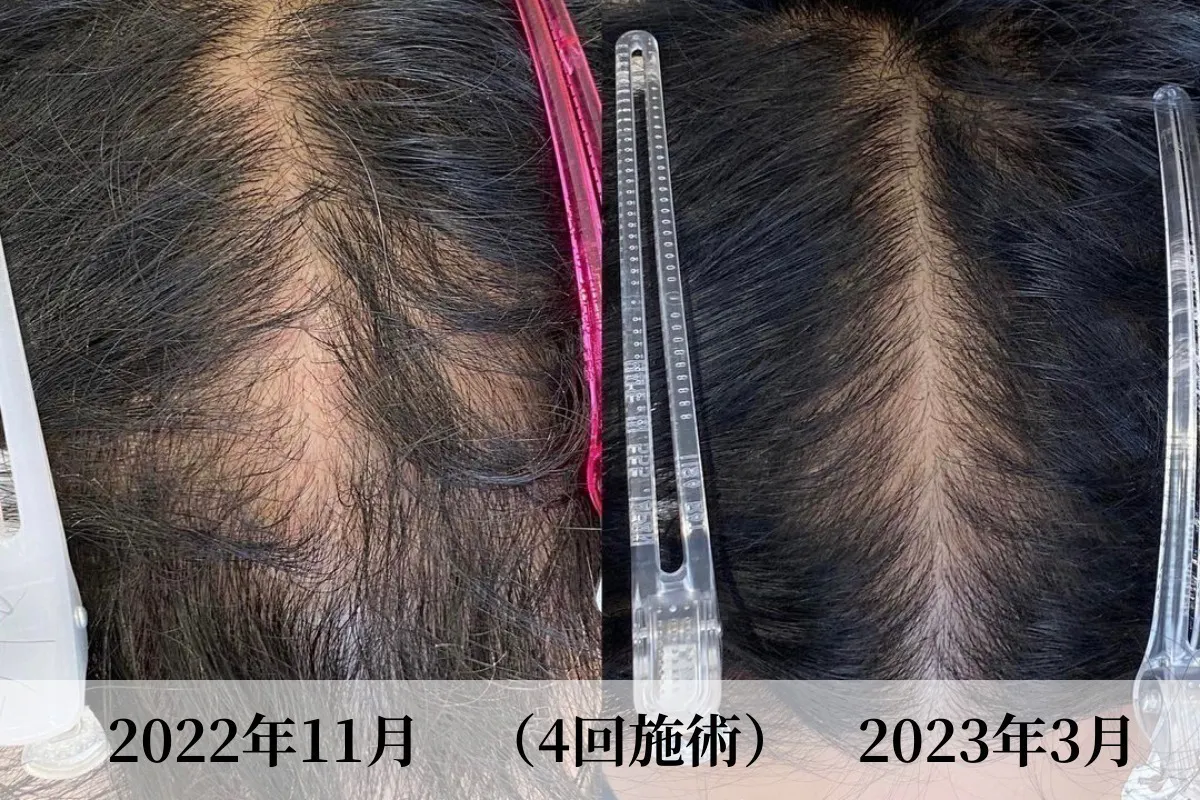 4番目のメイン画像