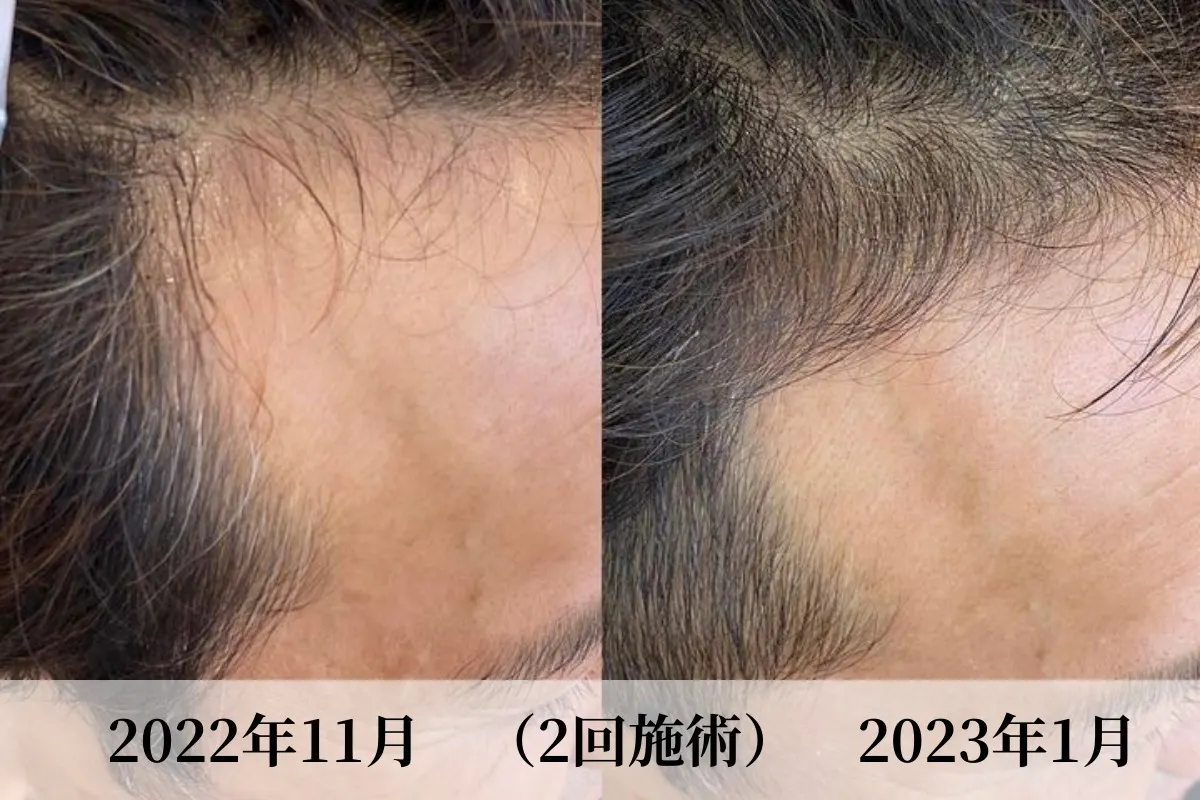 3番目のメイン画像