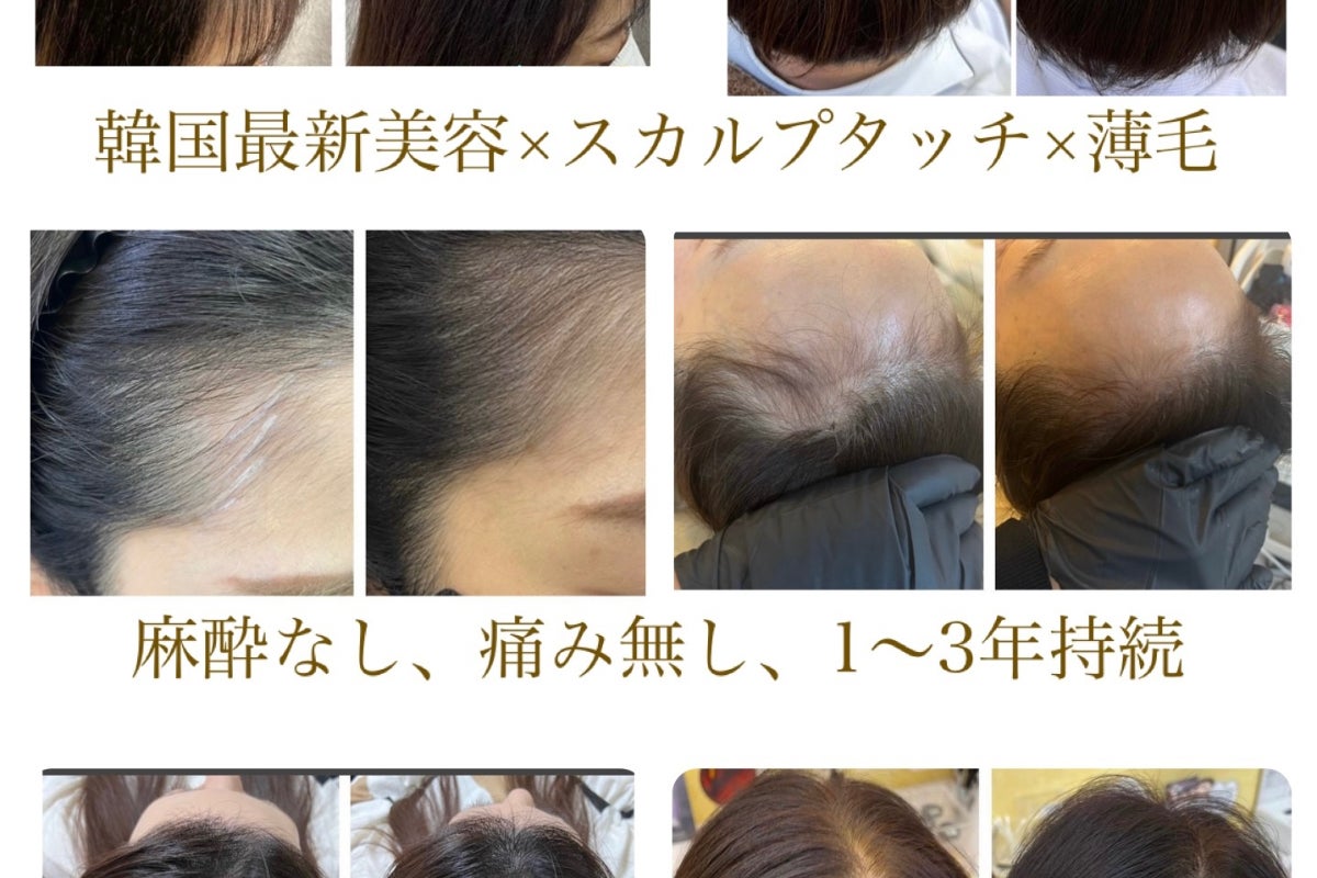 1番目のメイン画像