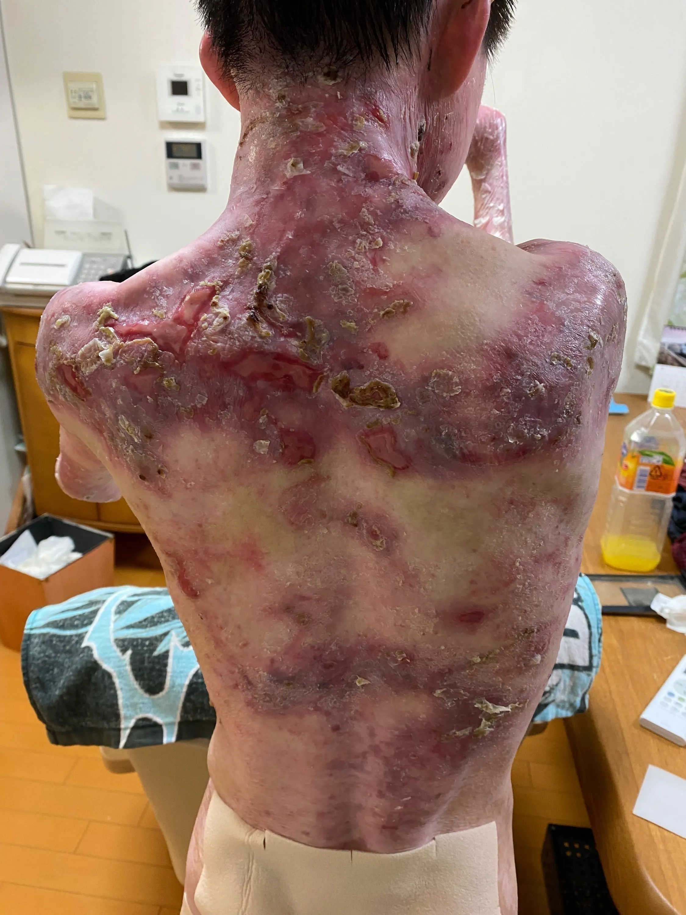 2番目のメイン画像