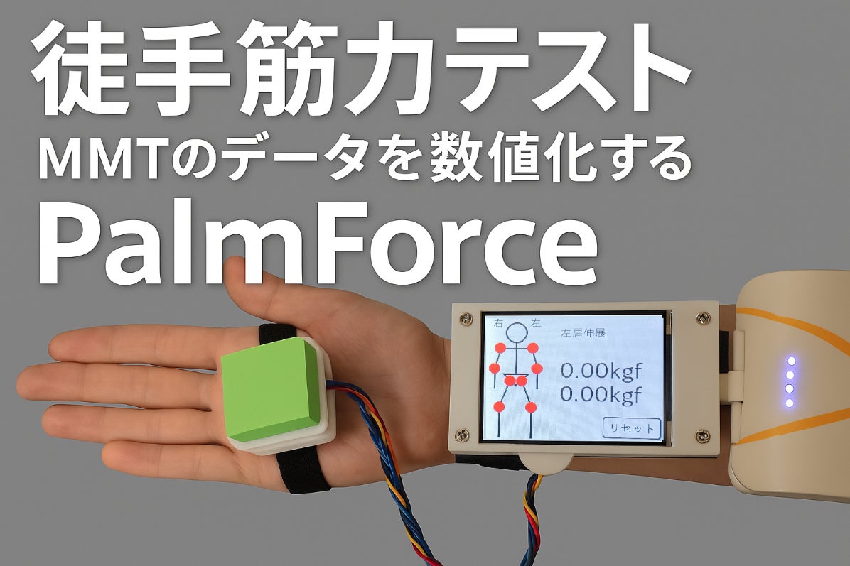 筋力計PalmForceで徒手筋力テストの結果を客観的に数値化する