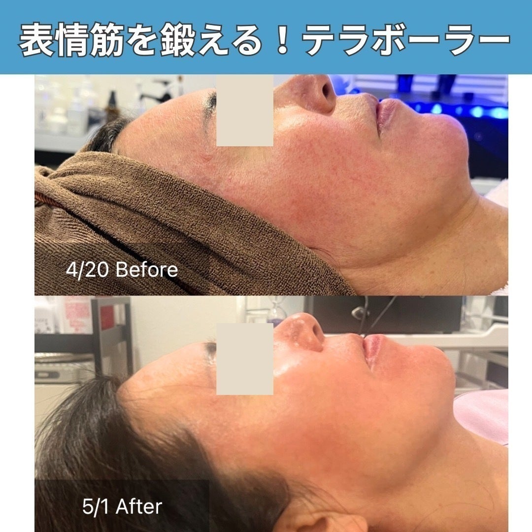 5番目のメイン画像