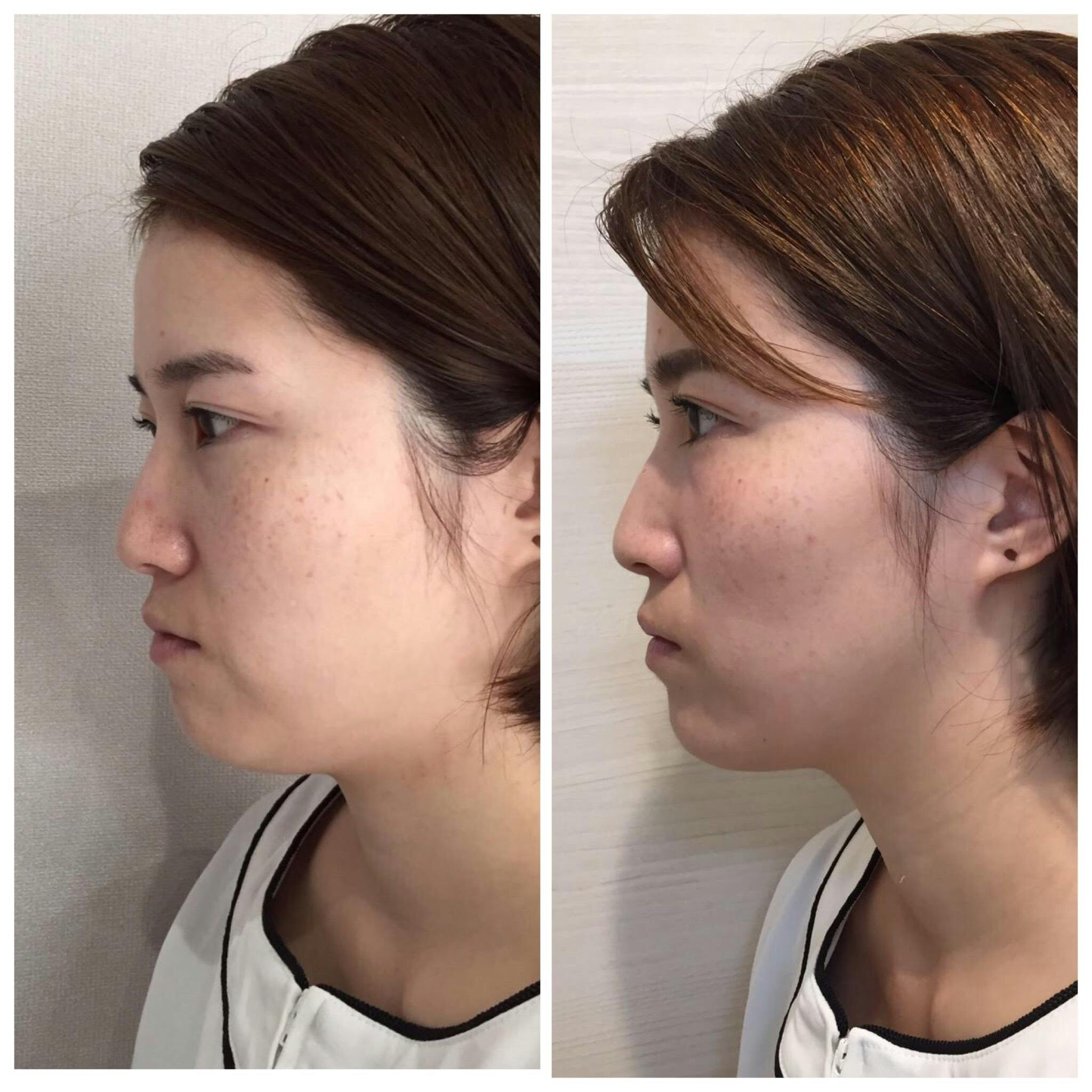 新型コロナで存続危機 北九州市口コミ3位獲得 小顔矯正専門店にご協力下さい Campfire キャンプファイヤー 新型コロナで存続危機 北九州市口コミ3位獲得 小顔矯正専門店にご協力下さい Campfire キャンプファイヤー