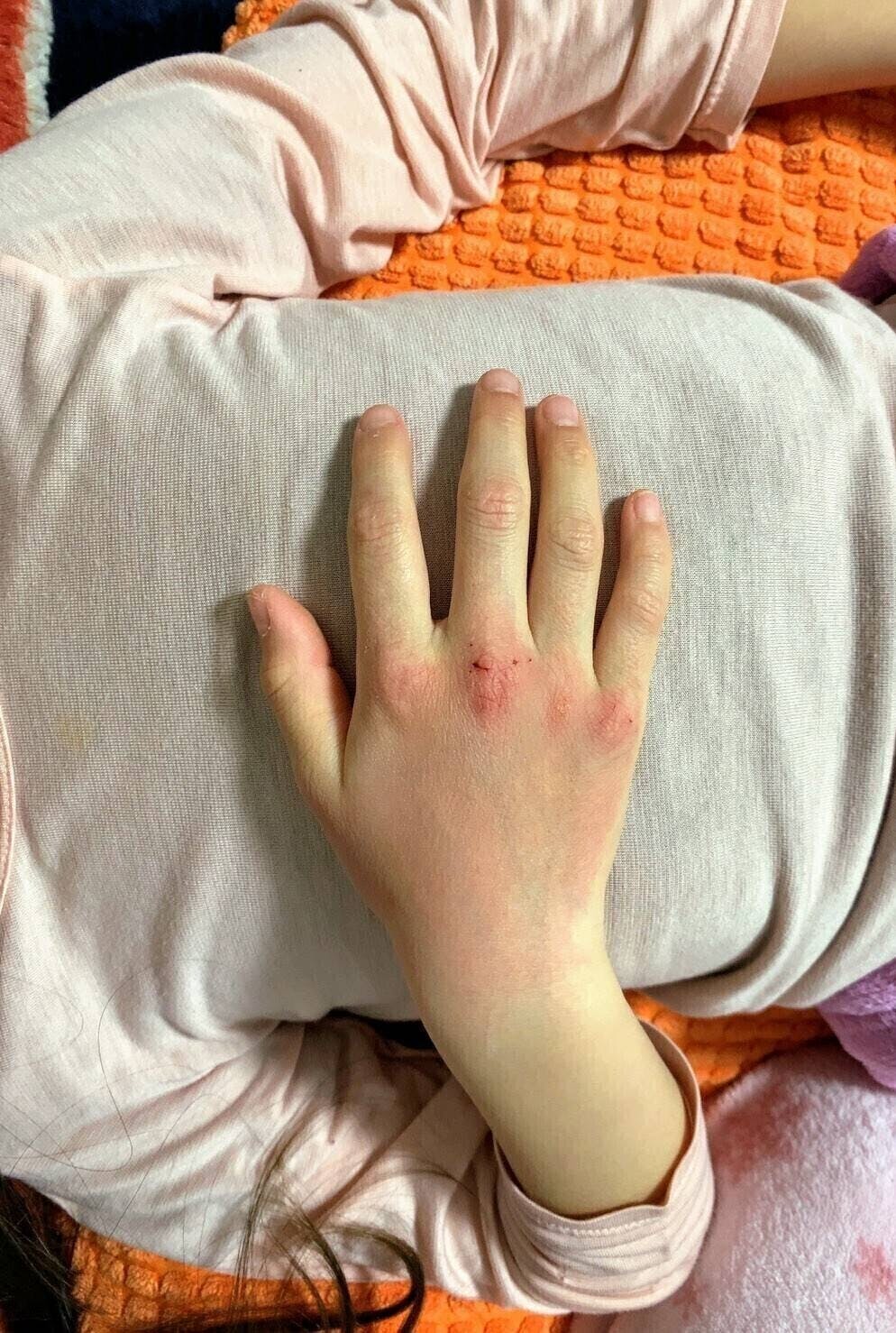 手荒れ 肌荒れ悩んでいる小学生にハンドクリームを提供したい の支援者一覧 Campfire キャンプファイヤー 手荒れ 肌荒れ悩んでいる小学生にハンドクリームを提供したい の支援者一覧 Campfire キャンプファイヤー