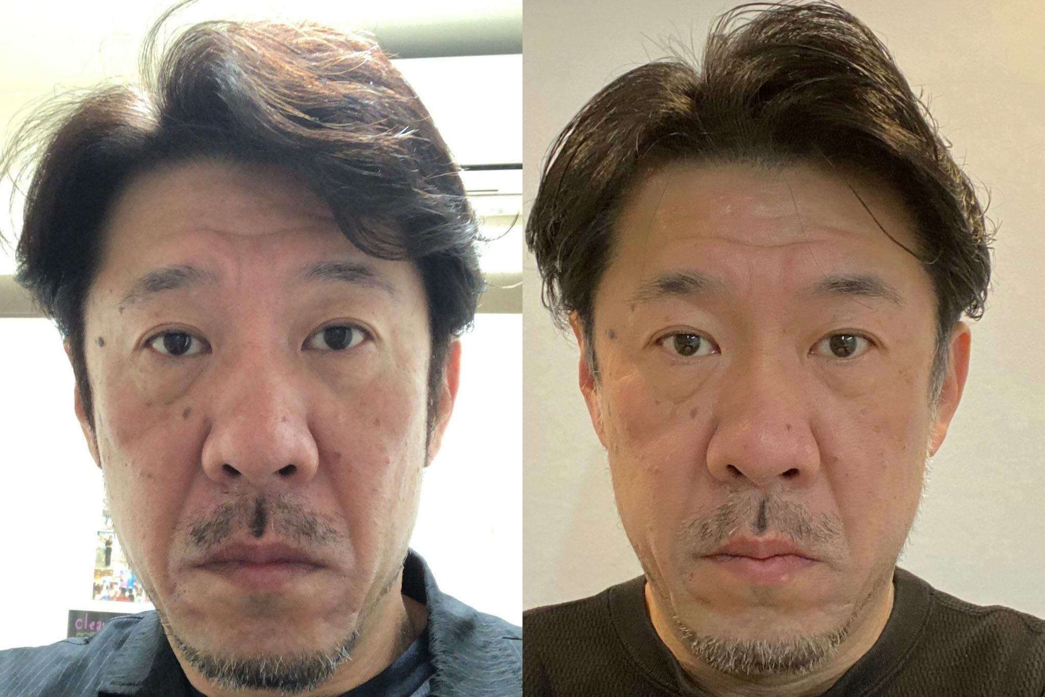 男だって若々しく小顔になりたい 大阪心斎橋に男性専用小顔 美肌サロンを作りたい Campfire キャンプファイヤー 男だって若々しく小顔になりたい 大阪心斎橋に男性専用小顔 美肌サロンを作りたい Campfire キャンプファイヤー