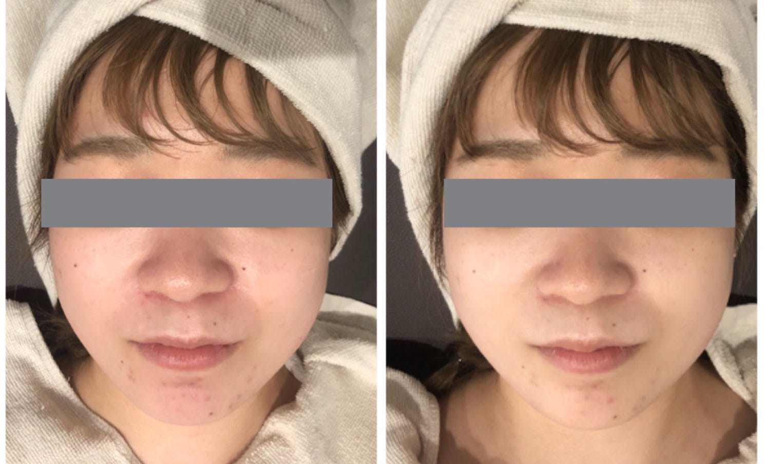 男だって若々しく小顔になりたい 大阪心斎橋に男性専用小顔 美肌サロンを作りたい Campfire キャンプファイヤー 男だって若々しく小顔になりたい 大阪心斎橋に男性専用小顔 美肌サロンを作りたい Campfire キャンプファイヤー