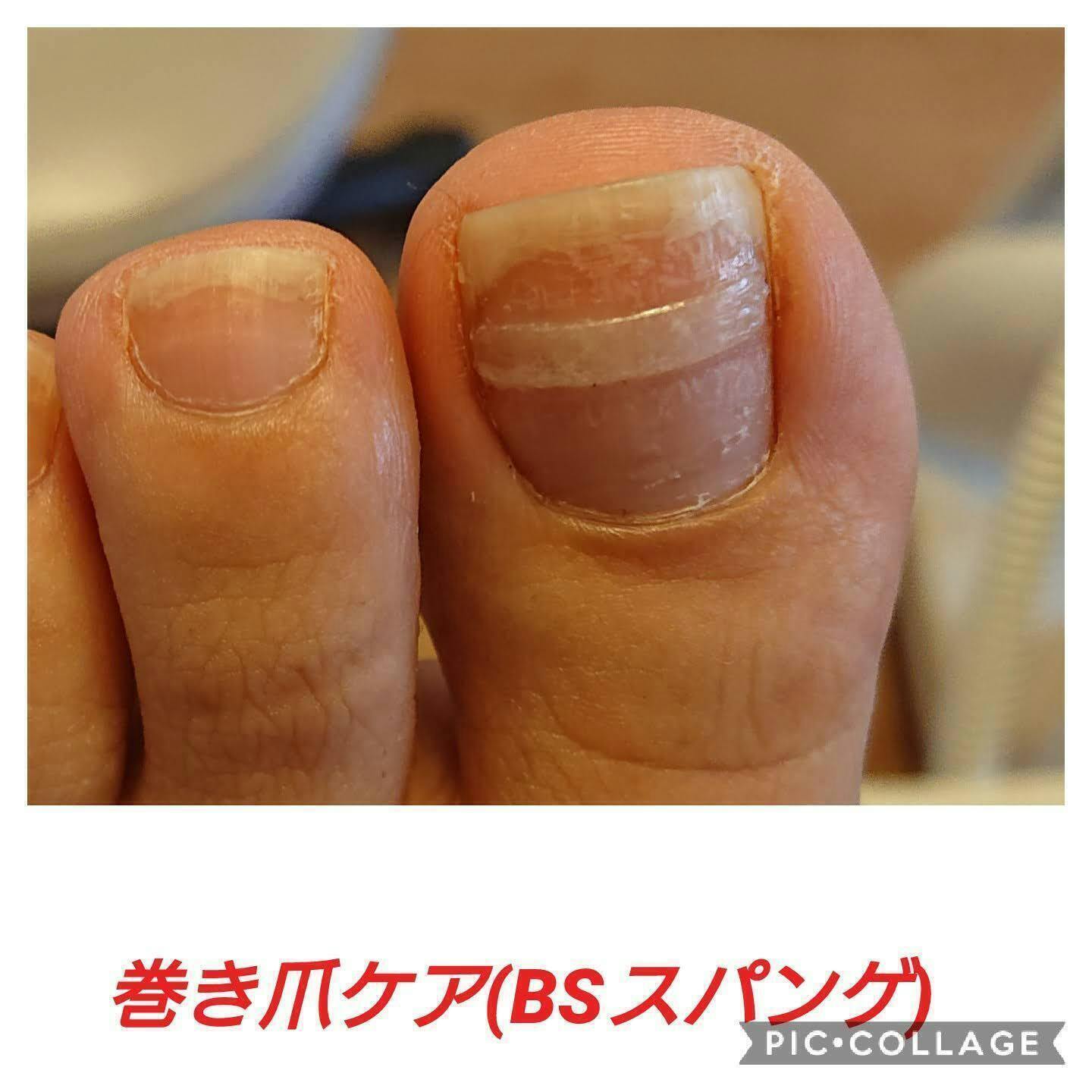 足 フット の役割って凄いんです 爪と足と歩行の専門店で未来の体を救いたい Campfire キャンプファイヤー 足 フット の役割って凄いんです 爪と足と歩行の専門店で未来の体を救いたい Campfire キャンプファイヤー