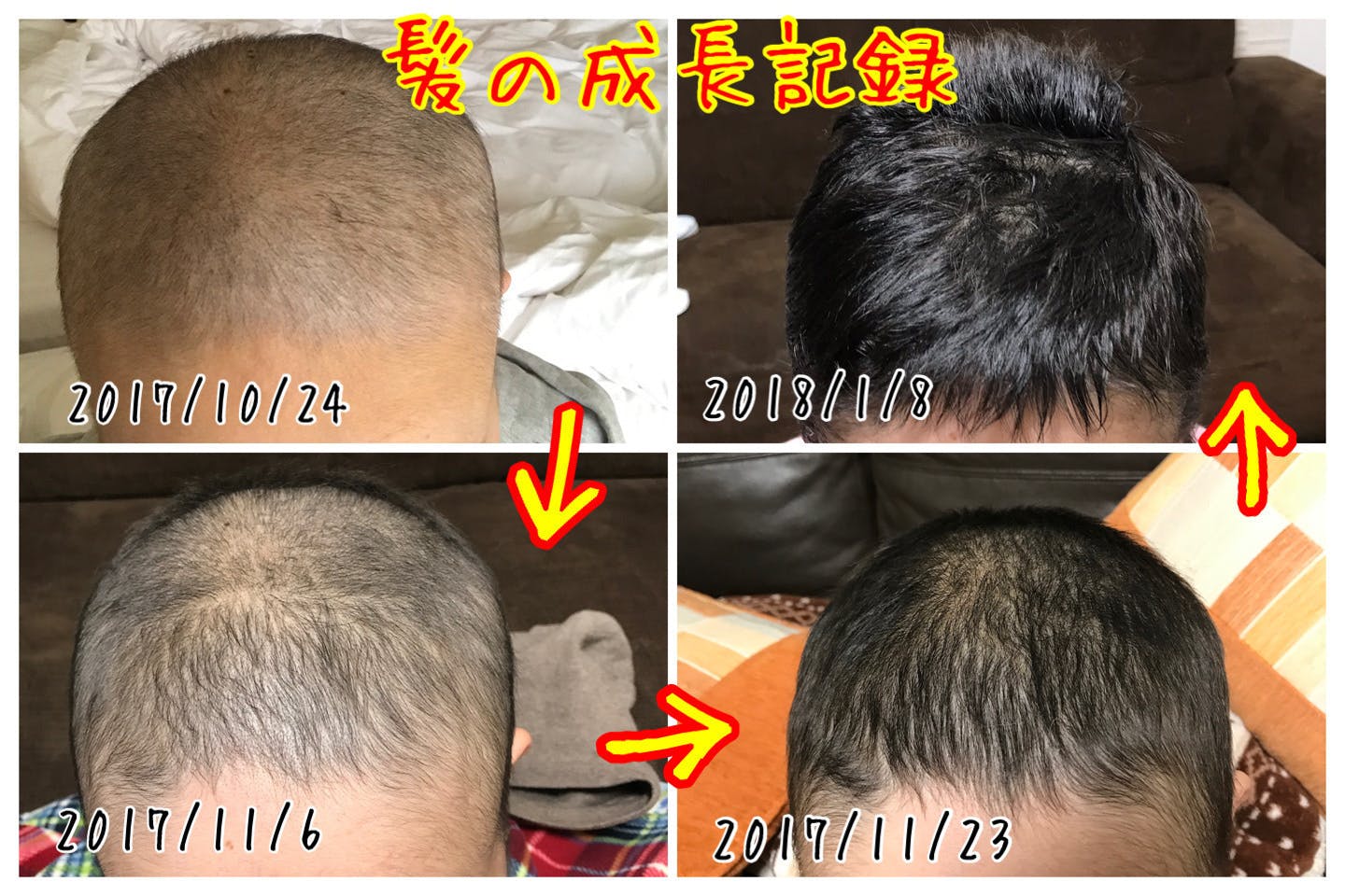 当事者だからわかる 癌患者 家族のための情報共有アプリを作りたい Campfire キャンプファイヤー 当事者だからわかる 癌患者 家族のための情報共有アプリを作りたい Campfire キャンプファイヤー