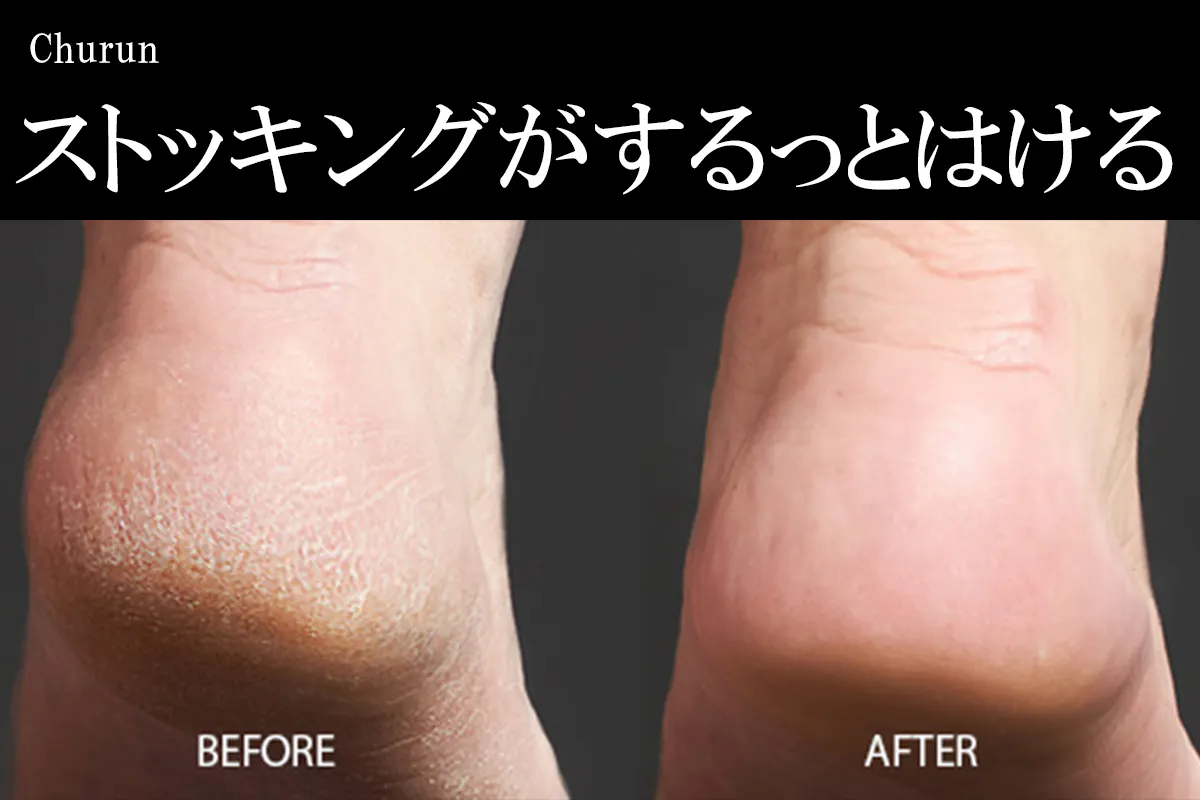 かかとチュルン 盛り上がった固い角質を除去 独自凹凸 ガラス製かかと角質ケア Campfire キャンプファイヤー かかとチュルン 盛り上がった固い角質を除去 独自凹凸 ガラス製かかと角質ケア Campfire キャンプファイヤー