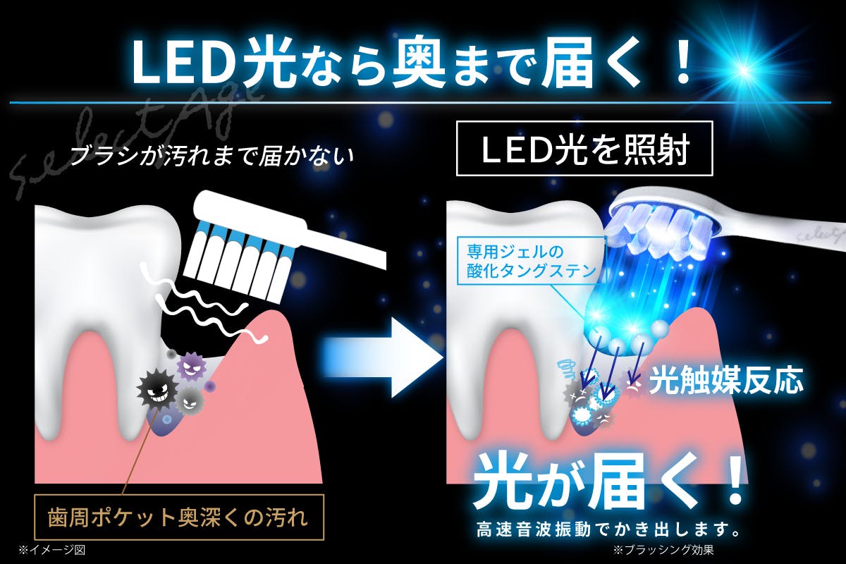 ホワイトニング LED 音波ブラシ www.krzysztofbialy.com