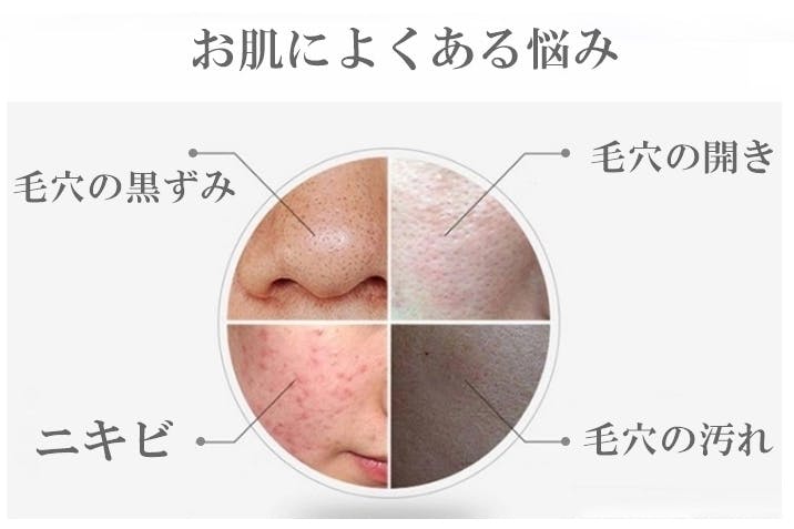 お肌は口ほどのものを言う 女性も男性も毛穴汚れゼロへ Face Pro 誕生 Campfire キャンプファイヤー お肌は口ほどのものを言う 女性も男性も毛穴汚れゼロへ Face Pro 誕生 Campfire キャンプファイヤー
