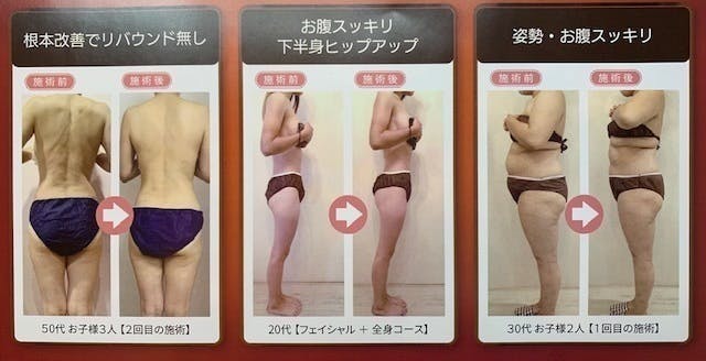 キレイを楽しむ 顔 体のコンプレックスやお悩みを解決したい Campfire キャンプファイヤー キレイを楽しむ 顔 体のコンプレックスやお悩みを解決したい Campfire キャンプファイヤー